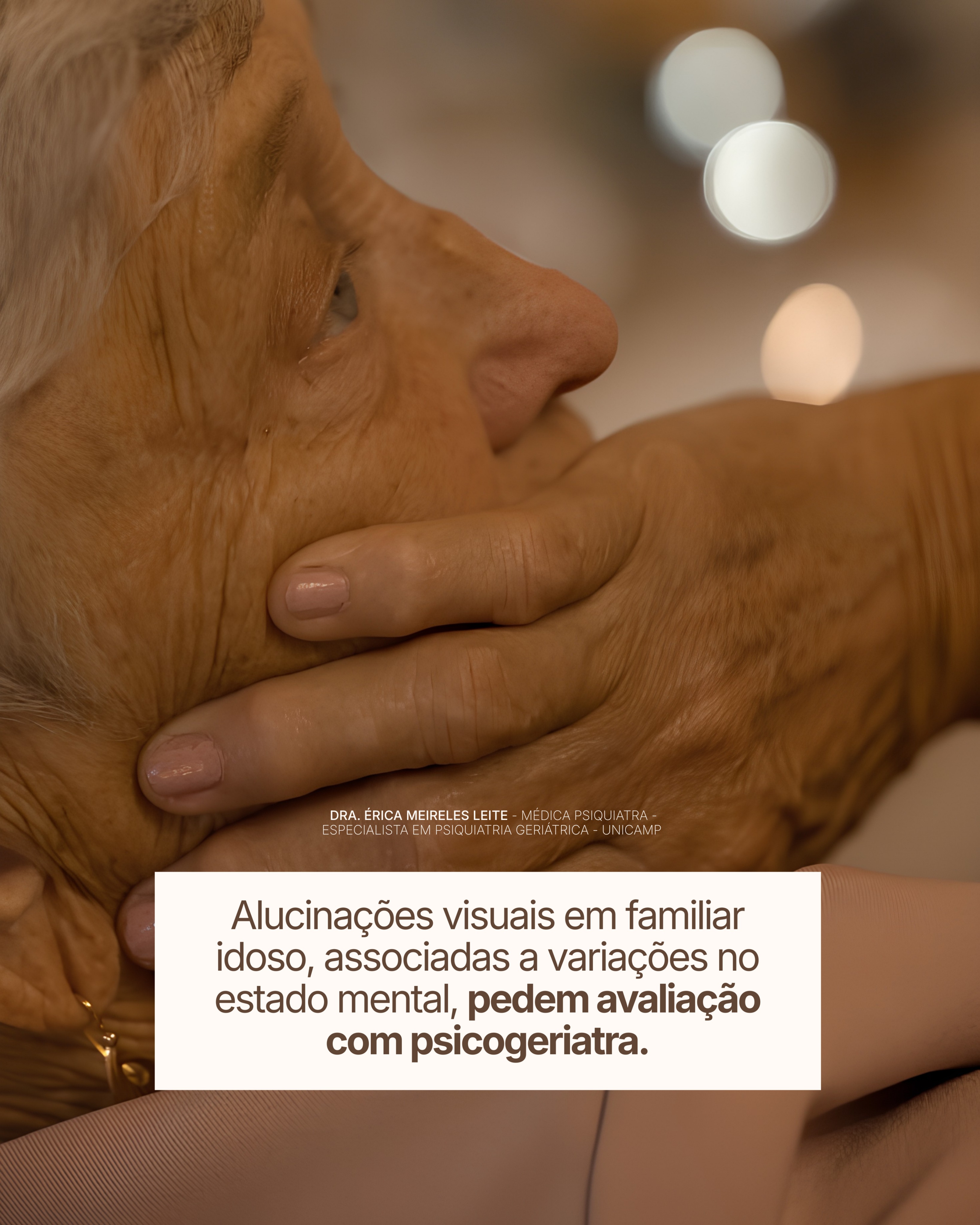 Demência por Corpos de Lewy — imagem 6